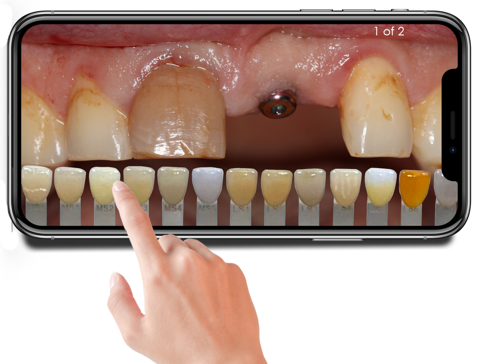 Chairside Shade Guide 8.0 by Luke Kahng